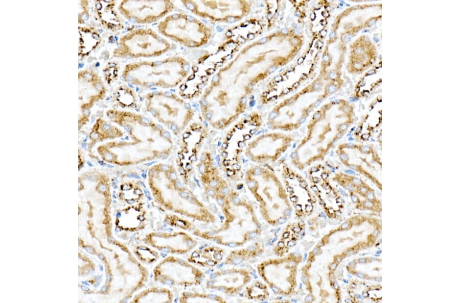 Immunohistochemistry - Anti-PSAP Antibody (A306382) - Antibodies.com