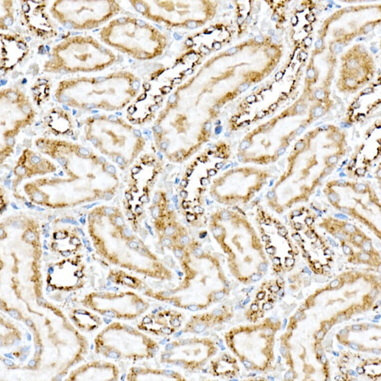 Immunohistochemistry - Anti-PSAP Antibody (A306382) - Antibodies.com