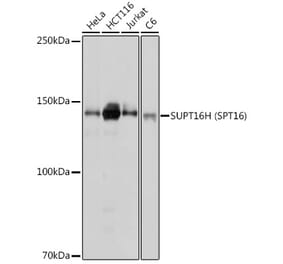 Western Blot - Anti-SUPT16H Antibody (A306383) - Antibodies.com