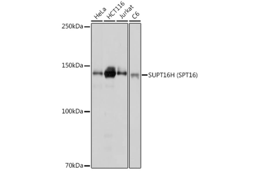 Western Blot - Anti-SUPT16H Antibody (A306383) - Antibodies.com