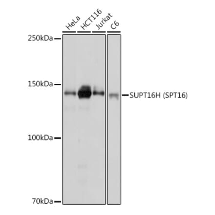 Western Blot - Anti-SUPT16H Antibody (A306383) - Antibodies.com