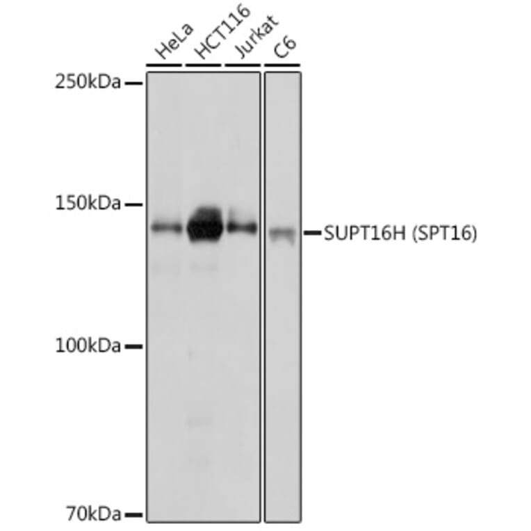 Western Blot - Anti-SUPT16H Antibody (A306383) - Antibodies.com