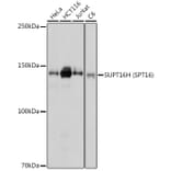 Western Blot - Anti-SUPT16H Antibody (A306383) - Antibodies.com