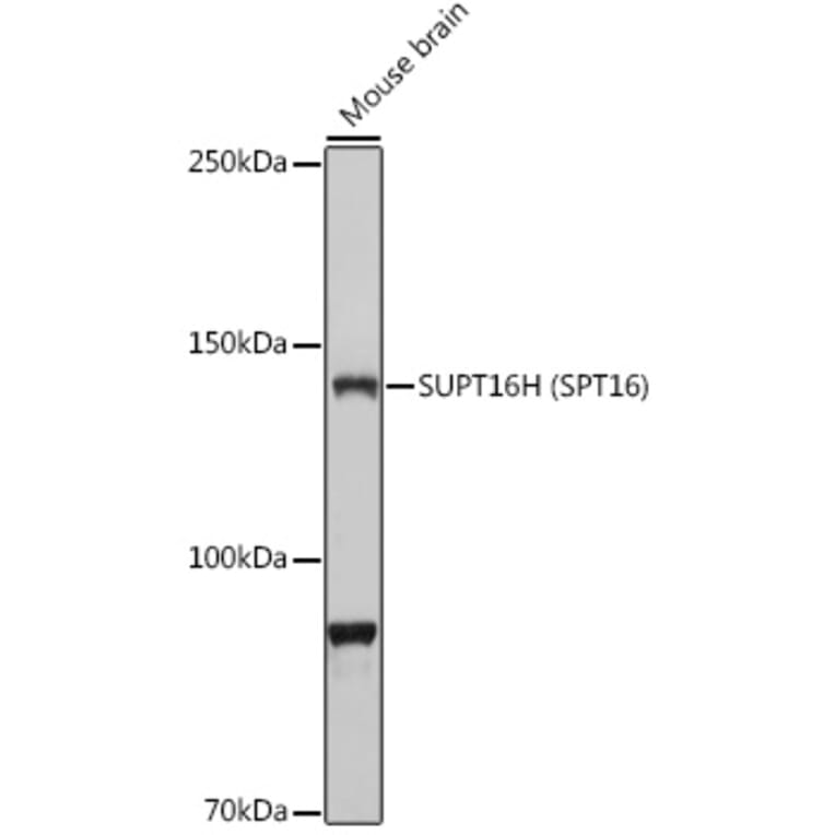 Western Blot - Anti-SUPT16H Antibody (A306383) - Antibodies.com