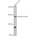 Western Blot - Anti-SUPT16H Antibody (A306383) - Antibodies.com