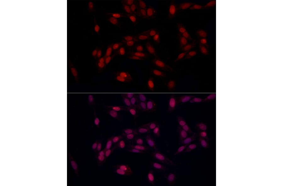 Immunofluorescence - Anti-SUPT16H Antibody (A306383) - Antibodies.com