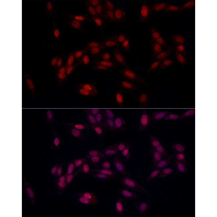 Immunofluorescence - Anti-SUPT16H Antibody (A306383) - Antibodies.com