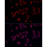 Immunofluorescence - Anti-SUPT16H Antibody (A306383) - Antibodies.com