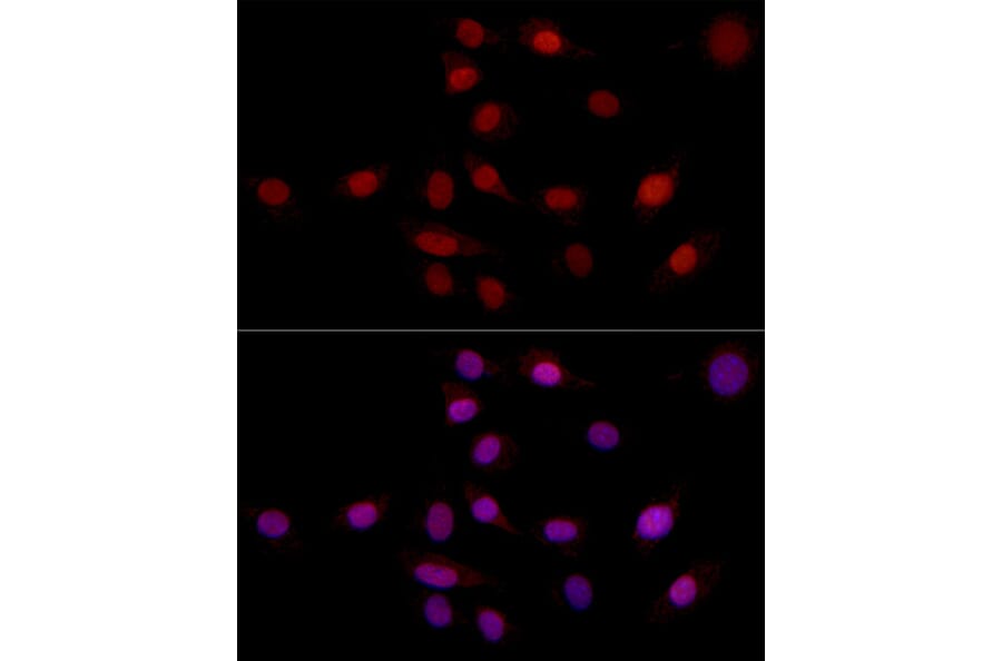 Immunofluorescence - Anti-SUPT16H Antibody (A306383) - Antibodies.com