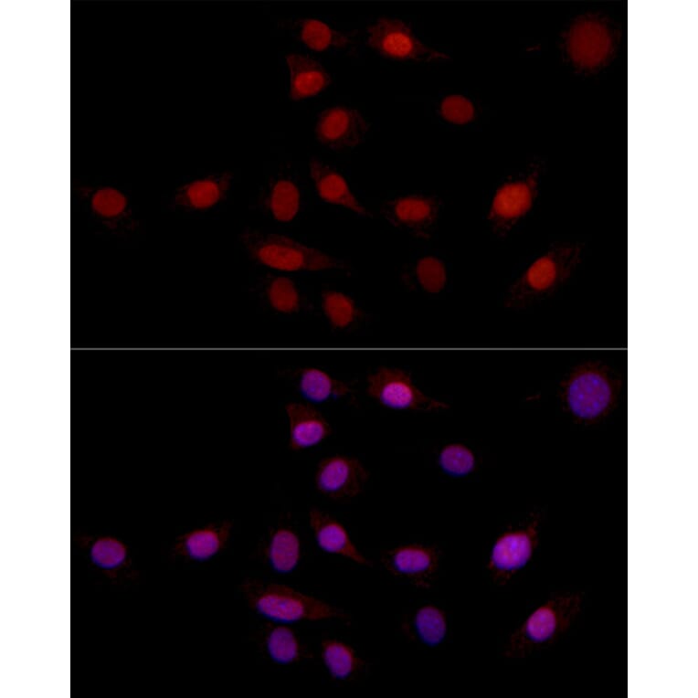 Immunofluorescence - Anti-SUPT16H Antibody (A306383) - Antibodies.com