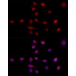 Immunofluorescence - Anti-SUPT16H Antibody (A306383) - Antibodies.com