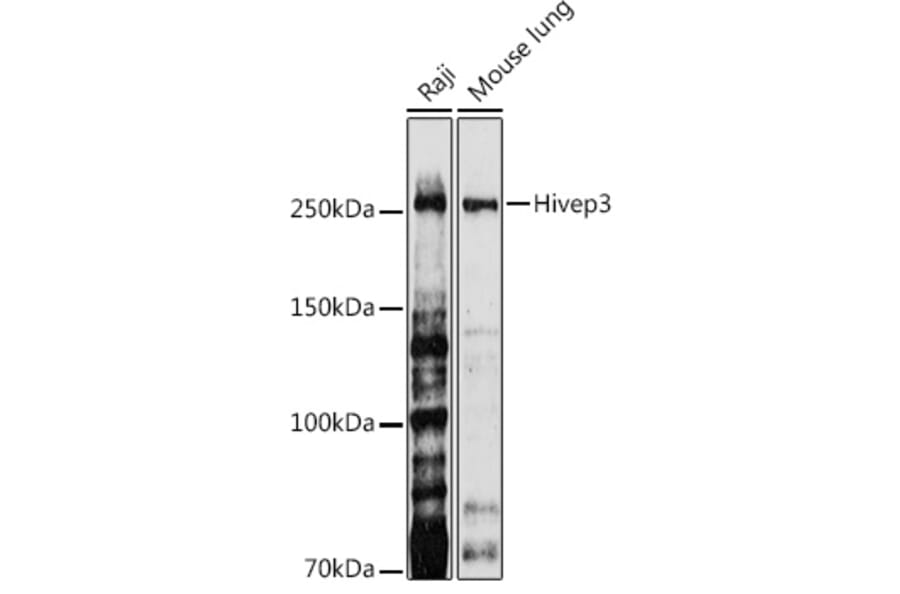 Western Blot - Anti-Hivep3 Antibody (A306384) - Antibodies.com