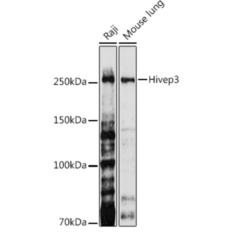Western Blot - Anti-Hivep3 Antibody (A306384) - Antibodies.com
