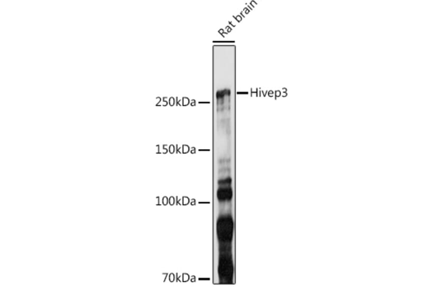 Western Blot - Anti-Hivep3 Antibody (A306384) - Antibodies.com