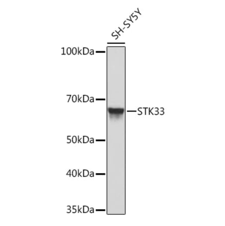 Western Blot - Anti-STK33 Antibody (A306386) - Antibodies.com