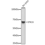 Western Blot - Anti-STK33 Antibody [ARC2330] (A306386) - Antibodies.com