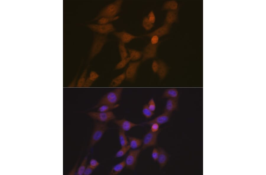 Immunofluorescence - Anti-STK33 Antibody [ARC2330] (A306386) - Antibodies.com