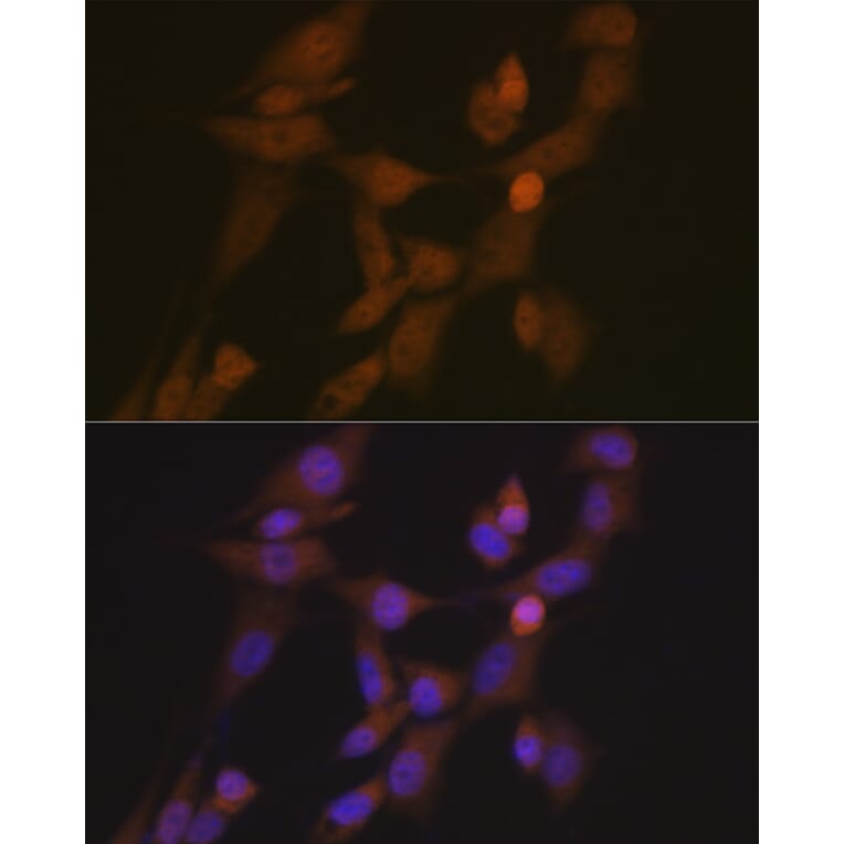 Immunofluorescence - Anti-STK33 Antibody [ARC2330] (A306386) - Antibodies.com