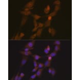 Immunofluorescence - Anti-STK33 Antibody [ARC2330] (A306386) - Antibodies.com