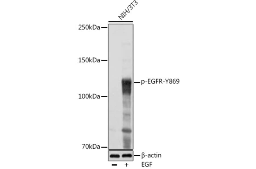 Western Blot - Anti-EGFR (phospho Tyr869) Antibody (A306387) - Antibodies.com