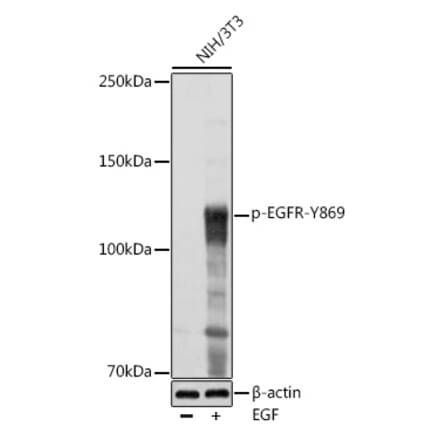 Western Blot - Anti-EGFR (phospho Tyr869) Antibody (A306387) - Antibodies.com
