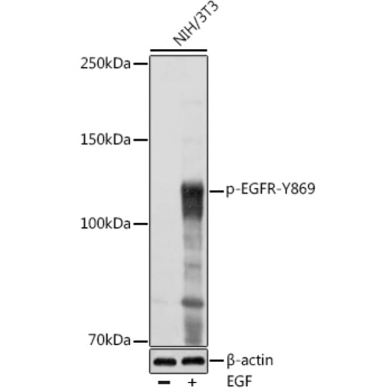 Western Blot - Anti-EGFR (phospho Tyr869) Antibody (A306387) - Antibodies.com