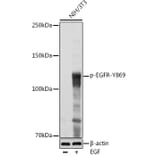 Western Blot - Anti-EGFR (phospho Tyr869) Antibody (A306387) - Antibodies.com