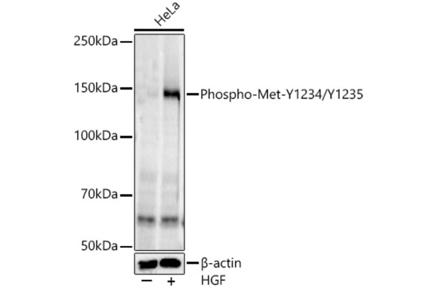 Western Blot - Anti-Met (c-Met) (phospho Tyr1234 + Tyr1235) Antibody [ARC54652] (A306389) - Antibodies.com