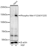 Western Blot - Anti-Met (c-Met) (phospho Tyr1234 + Tyr1235) Antibody [ARC54652] (A306389) - Antibodies.com