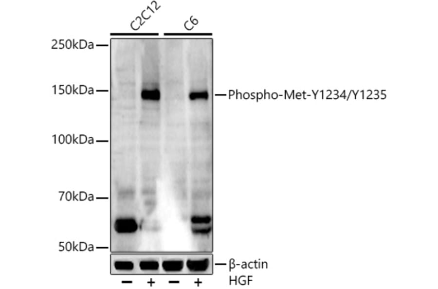 Western Blot - Anti-Met (c-Met) (phospho Tyr1234 + Tyr1235) Antibody [ARC54652] (A306389) - Antibodies.com