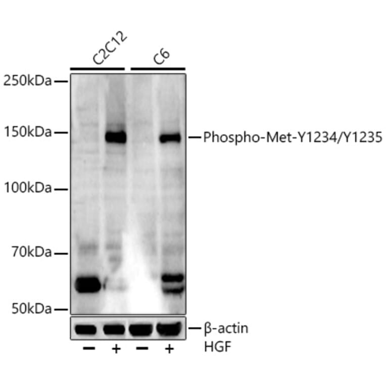 Western Blot - Anti-Met (c-Met) (phospho Tyr1234 + Tyr1235) Antibody [ARC54652] (A306389) - Antibodies.com