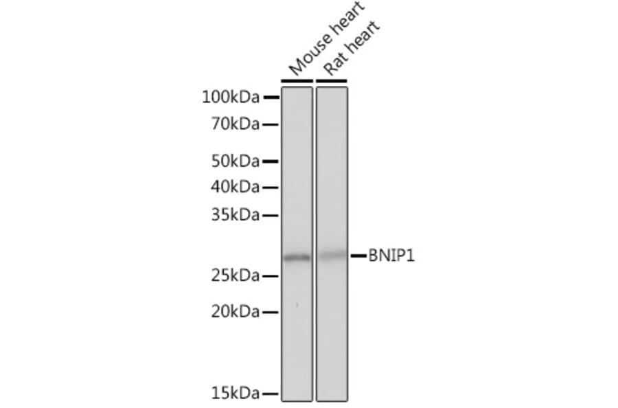 Western Blot - Anti-BNIP1 Antibody [ARC2137] (A306390) - Antibodies.com