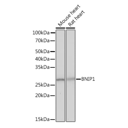 Western Blot - Anti-BNIP1 Antibody [ARC2137] (A306390) - Antibodies.com