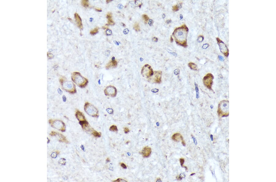 Immunohistochemistry - Anti-BNIP1 Antibody [ARC2137] (A306390) - Antibodies.com