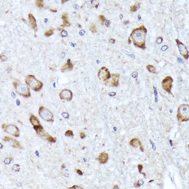 Immunohistochemistry - Anti-BNIP1 Antibody [ARC2137] (A306390) - Antibodies.com
