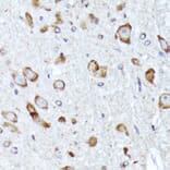 Immunohistochemistry - Anti-BNIP1 Antibody [ARC2137] (A306390) - Antibodies.com