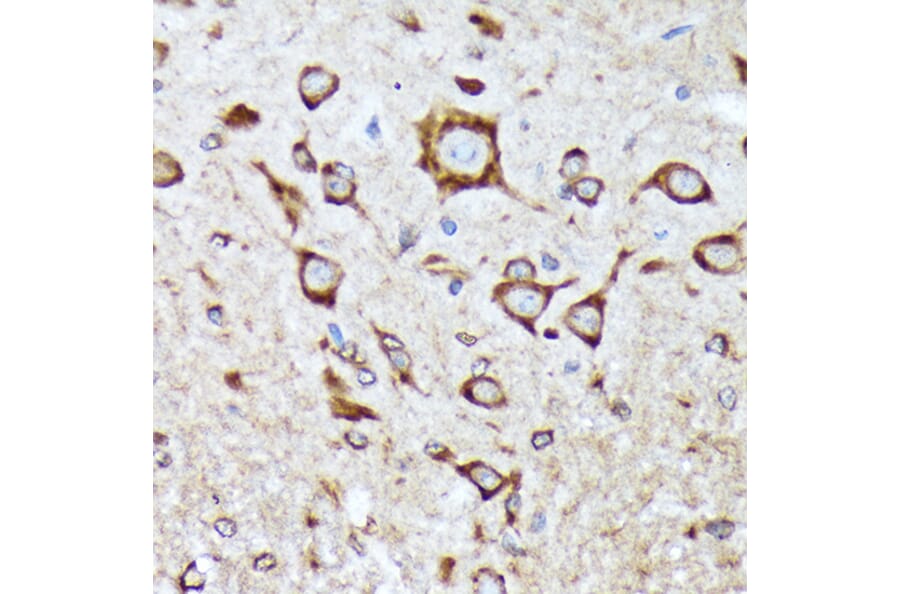 Immunohistochemistry - Anti-BNIP1 Antibody [ARC2137] (A306390) - Antibodies.com