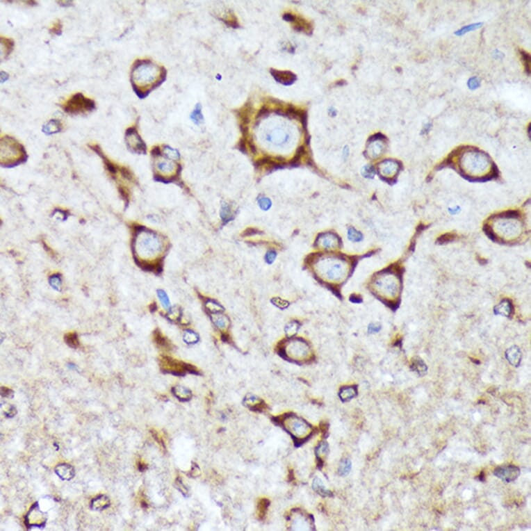 Immunohistochemistry - Anti-BNIP1 Antibody [ARC2137] (A306390) - Antibodies.com