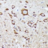 Immunohistochemistry - Anti-BNIP1 Antibody [ARC2137] (A306390) - Antibodies.com