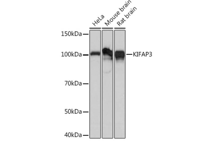 Western Blot - Anti-KIFAP3 Antibody [ARC1211] (A306391) - Antibodies.com