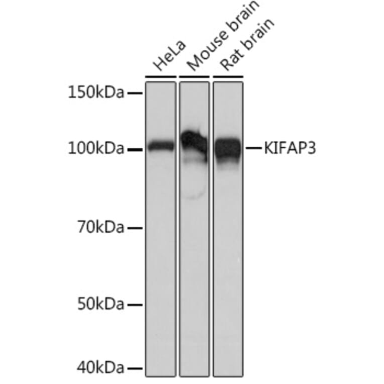 Western Blot - Anti-KIFAP3 Antibody [ARC1211] (A306391) - Antibodies.com