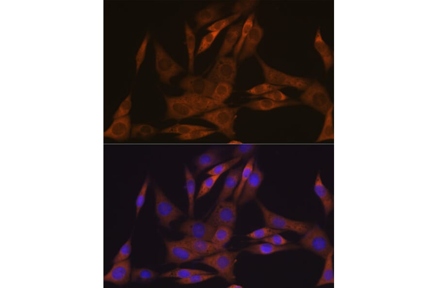 Immunofluorescence - Anti-KIFAP3 Antibody [ARC1211] (A306391) - Antibodies.com