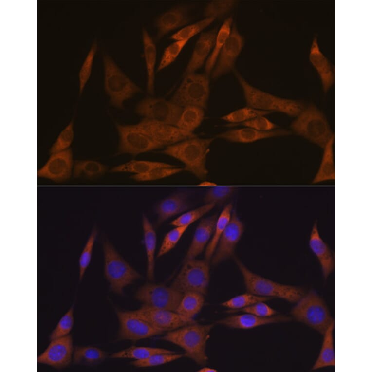 Immunofluorescence - Anti-KIFAP3 Antibody [ARC1211] (A306391) - Antibodies.com