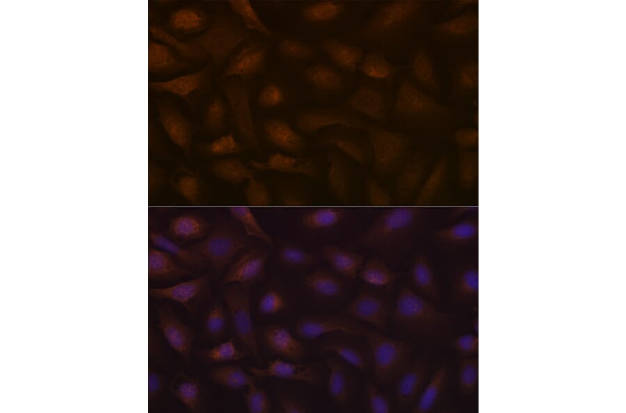 Immunofluorescence - Anti-KIFAP3 Antibody [ARC1211] (A306391) - Antibodies.com