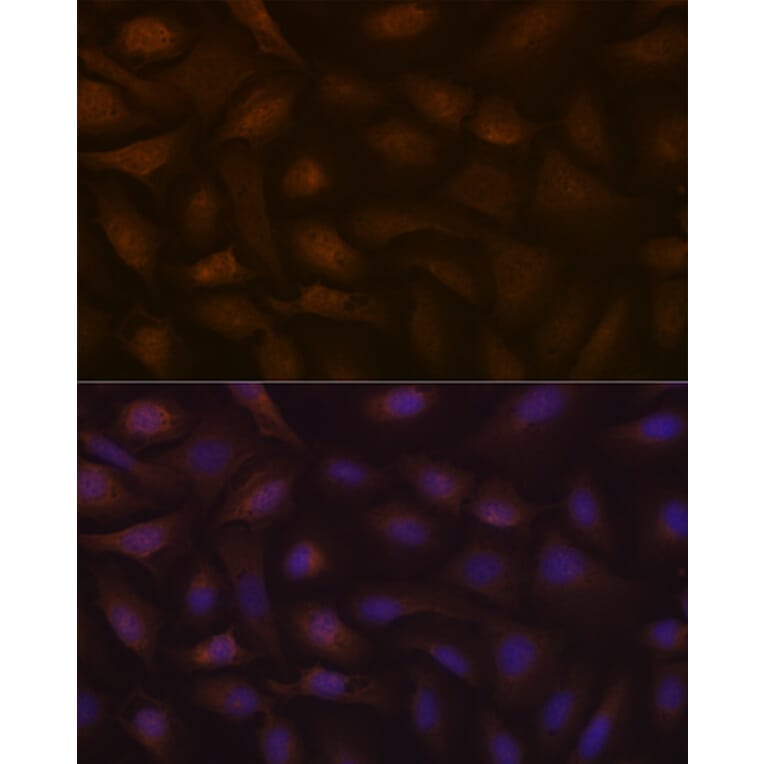 Immunofluorescence - Anti-KIFAP3 Antibody [ARC1211] (A306391) - Antibodies.com