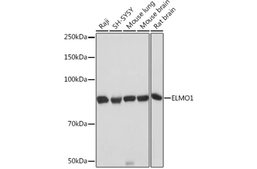 Western Blot - Anti-ELMO1 Antibody [ARC1985] (A306392) - Antibodies.com