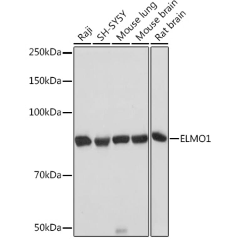 Western Blot - Anti-ELMO1 Antibody [ARC1985] (A306392) - Antibodies.com