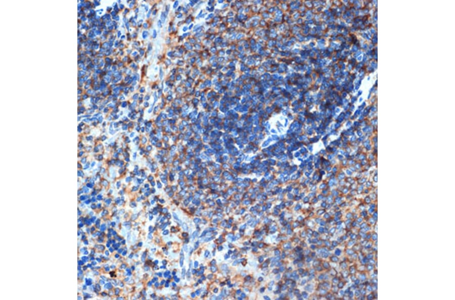 Immunohistochemistry - Anti-ELMO1 Antibody [ARC1985] (A306392) - Antibodies.com