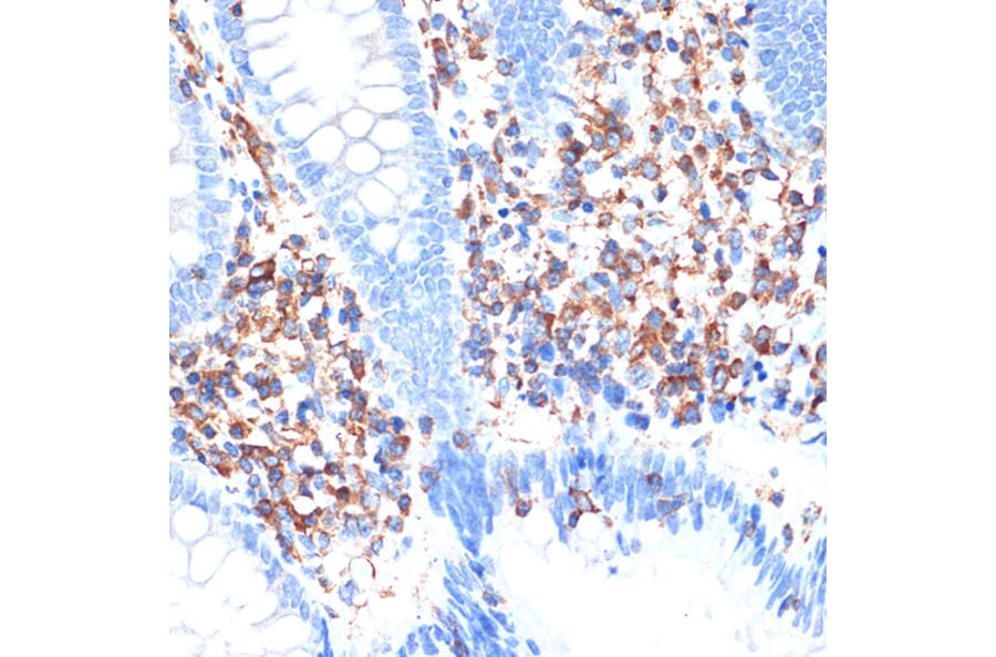 Immunohistochemistry - Anti-ELMO1 Antibody [ARC1985] (A306392) - Antibodies.com
