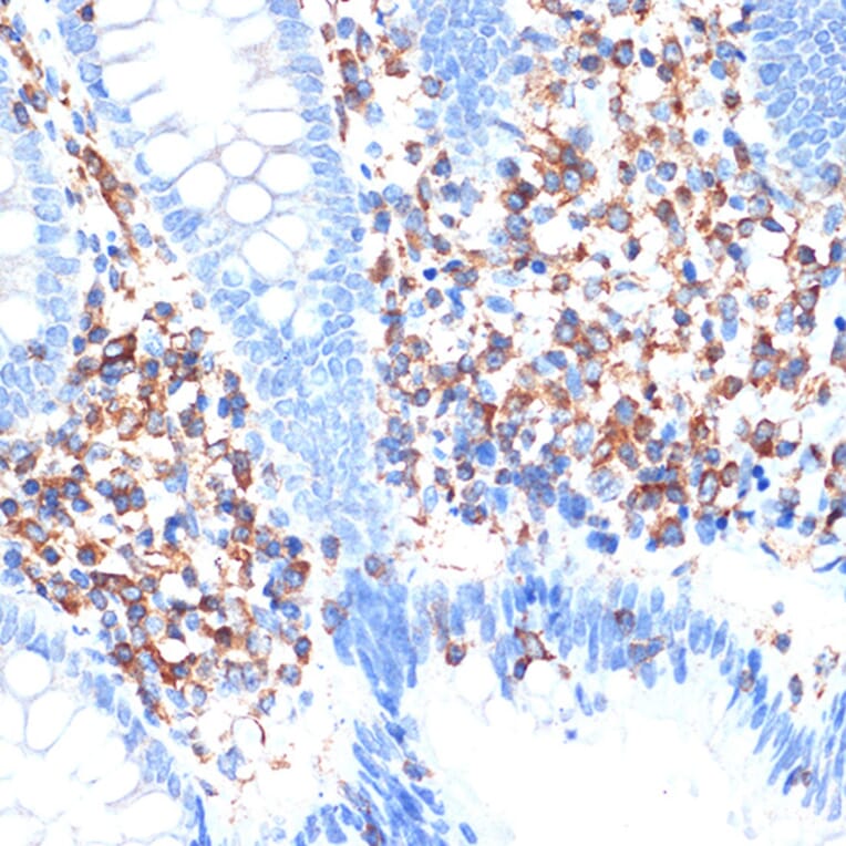 Immunohistochemistry - Anti-ELMO1 Antibody [ARC1985] (A306392) - Antibodies.com